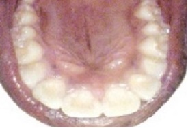 clear aligners ilford