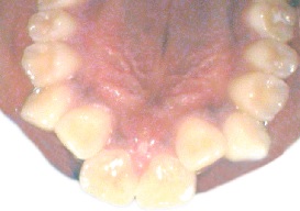 clear aligners ilford