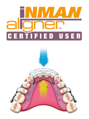 Inman Aligners in Essex